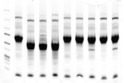 glycoprotein