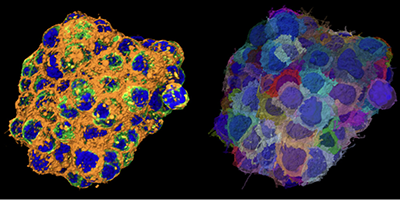 Zeiss_Inventia_Webinar_400px